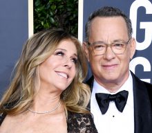 Rita Wilson marks a year since she and husband Tom Hanks caught COVID-19