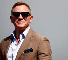 Daniel Craig does entire interview without realising his head is bleeding