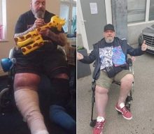 Ex-IRON MAIDEN Singer PAUL DI’ANNO To Be Fitted For Custom Leg Brace In Preparation For Surgery