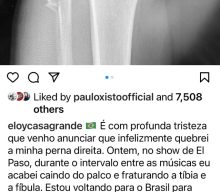 SEPULTURA Drummer ELOY CASAGRANDE Breaks Right Leg In Stage Accident; Tour To Continue Without Him