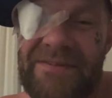 FIVE FINGER DEATH PUNCH Singer Injures Eye After Being Exposed To A Laser Beam